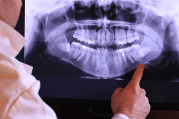 Best Emergency Dentist for Knocked-Out Tooth in Nashville, AR