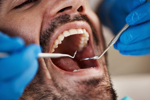 Best Emergency Root Canal Treatment in Nashville, AR
